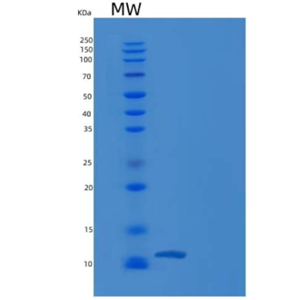 Recombinant Human TFAP2C / AP2-GAMMA Protein (His tag),Recombinant Human TFAP2C / AP2-GAMMA Protein (His tag)