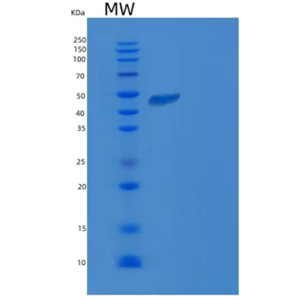 Recombinant Human DOT1L / KMT4 Protein,Recombinant Human DOT1L / KMT4 Protein