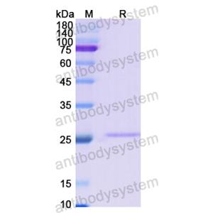 重组COL4A2蛋白,Recombinant Human COL4A2, N-His