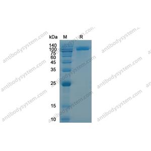 重组CD228/MELTF蛋白,Recombinant Human CD228/MELTF, C-His