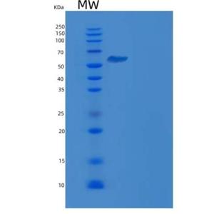 Recombinant Human NEK7 Protein (His & GST tag)