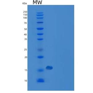 Recombinant Human PMP2 / FABP8 Protein (His tag)