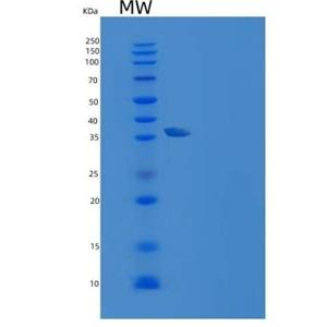 Recombinant Rat CD155 / PVR / NECL5 Protein (His tag),Recombinant Rat CD155 / PVR / NECL5 Protein (His tag)