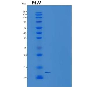 Recombinant Mouse TALLA-1 / TSPAN7 Protein (His tag)