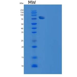Recombinant Rat RBP4 Protein (His tag)