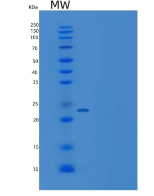 Recombinant Human CRADD / RAIDD Protein (His tag),Recombinant Human CRADD / RAIDD Protein (His tag)