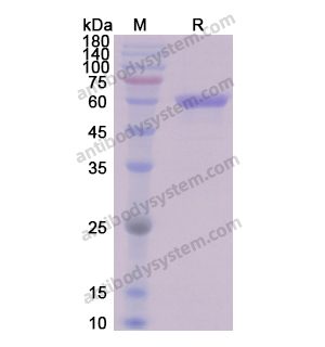 重組VIM/Vimentin蛋白,Recombinant Human VIM/Vimentin, N-His