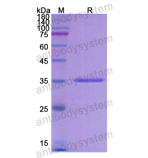 重組CYP21A2蛋白,Recombinant Human CYP21A2, N-His