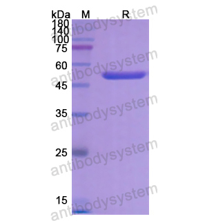 重组SERPINF2蛋白,Recombinant Human SERPINF2, N-His