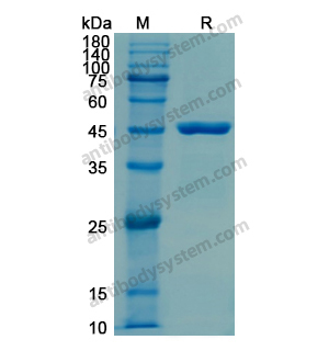 重組KRT19/CK19蛋白,Recombinant Human KRT19/CK19, N-His