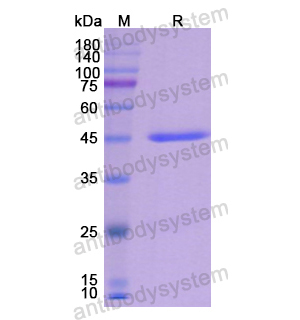 重組KRT19/CK19蛋白,Recombinant Human KRT19/CK19, C-His