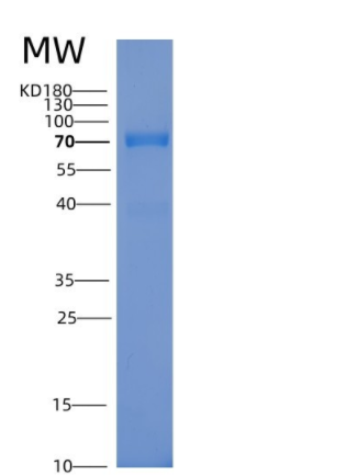 Recombinant Human PS6K / RPS6KB1 Protein (GST tag),Recombinant Human PS6K / RPS6KB1 Protein (GST tag)