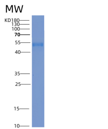 Recombinant Mouse ICAM-1 / CD54 Protein (His tag),Recombinant Mouse ICAM-1 / CD54 Protein (His tag)