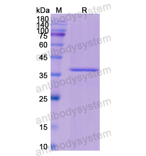 重组KRT16蛋白,Recombinant Human KRT16, N-His