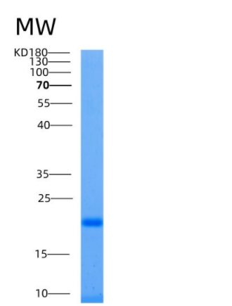 Recombinant Human Ube2L6 Protein (His Tag),Recombinant Human Ube2L6 Protein (His Tag)