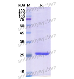 重组IGFBP1蛋白,Recombinant Human IGFBP1, N-His