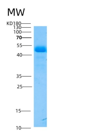 Recombinant Mouse ASM3A / SMPDL3A Protein (His Tag),Recombinant Mouse ASM3A / SMPDL3A Protein (His Tag)