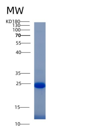 Recombinant Human IFI30 Protein (His tag),Recombinant Human IFI30 Protein (His tag)