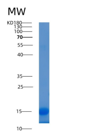 Recombinant Human LAMTOR2 / ROBLD3 / MAPBPIP Protein (His tag),Recombinant Human LAMTOR2 / ROBLD3 / MAPBPIP Protein (His tag)