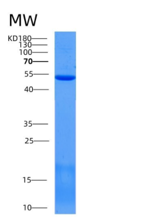 Recombinant Mouse SCPEP1 / RISC Protein (His Tag),Recombinant Mouse SCPEP1 / RISC Protein (His Tag)