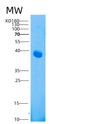 Recombinant Human CD208 / LAMP3 / DC-LAMP Protein (His tag),Recombinant Human CD208 / LAMP3 / DC-LAMP Protein (His tag)