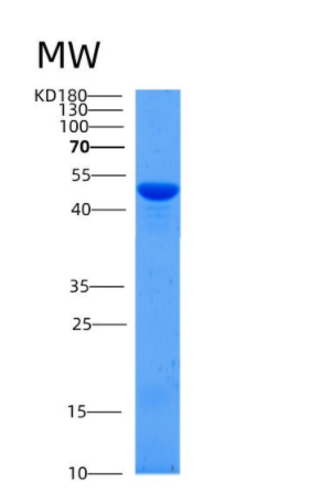 Recombinant Mouse SerpinB12 Protein (His tag),Recombinant Mouse SerpinB12 Protein (His tag)