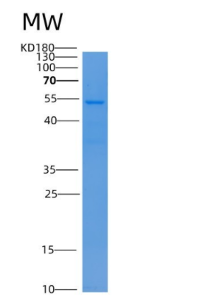 Recombinant Human LBP Protein (His Tag),Recombinant Human LBP Protein (His Tag)