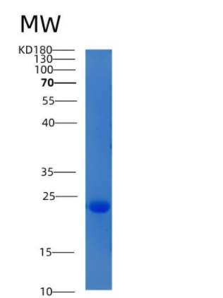 Recombinant Human CIB2 / KIP-2 Protein (His tag),Recombinant Human CIB2 / KIP-2 Protein (His tag)