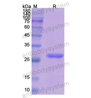 重组Elastase-3B/CELA3B蛋白,Recombinant Human Elastase-3B/CELA3B, N-His