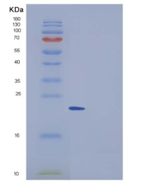 Recombinant Human CNDP1 Protein (His Tag),Recombinant Human CNDP1 Protein (His Tag)