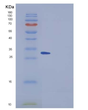 Recombinant Mouse SPARCL1 / SPARC-like 1 Protein (His tag),Recombinant Mouse SPARCL1 / SPARC-like 1 Protein (His tag)