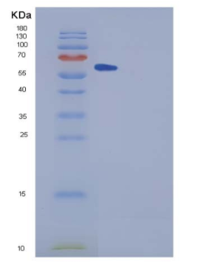 Recombinant Human SPG21 Protein (GST tag),Recombinant Human SPG21 Protein (GST tag)