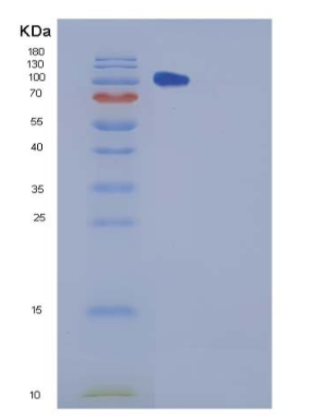 Recombinant Mouse CHL-1 Protein,Recombinant Mouse CHL-1 Protein