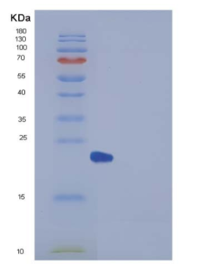 Recombinant Human Peroxiredoxin 2 / PRDX2 Protein (His tag),Recombinant Human Peroxiredoxin 2 / PRDX2 Protein (His tag)