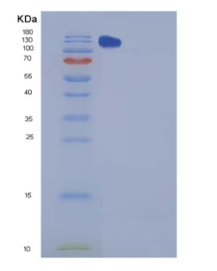 Recombinant Mouse CHL-1 Protein (Fc tag),Recombinant Mouse CHL-1 Protein (Fc tag)