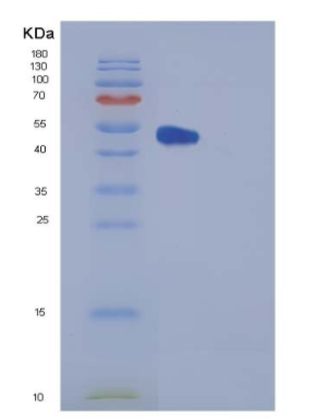 Recombinant Human FKBP3 / FKBP25 Protein (GST tag),Recombinant Human FKBP3 / FKBP25 Protein (GST tag)