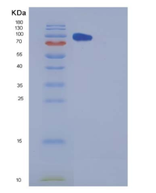 Recombinant Human Carboxypeptidase E / CPE Protein (Fc tag),Recombinant Human Carboxypeptidase E / CPE Protein (Fc tag)