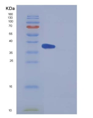 Recombinant Mouse IL5Ra / CD125 Protein (His tag),Recombinant Mouse IL5Ra / CD125 Protein (His tag)