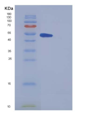 Recombinant Mouse METAP2 / MAP2 Protein (His tag),Recombinant Mouse METAP2 / MAP2 Protein (His tag)