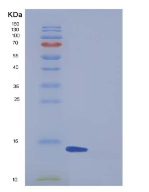 Recombinant Human FABP6 / I-BABP Protein,Recombinant Human FABP6 / I-BABP Protein