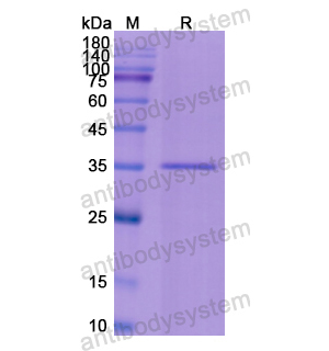 重组ROS1蛋白,Recombinant Human ROS1, N-His