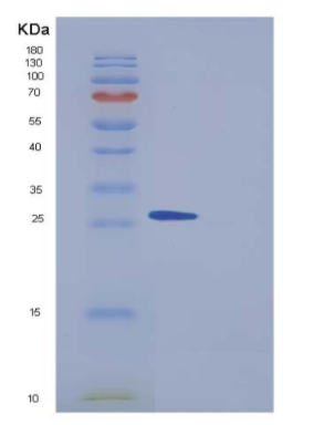 Recombinant Human PPM1G / PP2C-gamma Protein (aa 317-546, His tag),Recombinant Human PPM1G / PP2C-gamma Protein (aa 317-546, His tag)