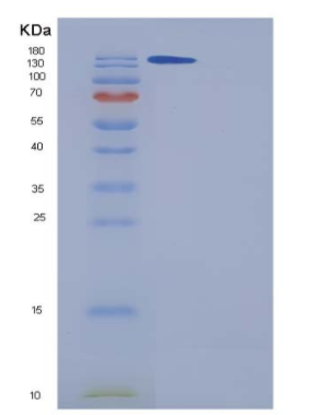 Recombinant Human A2M / CPAMD5 / Alpha-2-macroglobulin Protein (His tag),Recombinant Human A2M / CPAMD5 / Alpha-2-macroglobulin Protein (His tag)