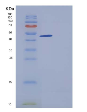 Recombinant Human ACPL2 Protein (His tag),Recombinant Human ACPL2 Protein (His tag)