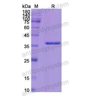 重组CD63蛋白,Recombinant Human CD63, N-GST