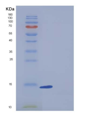 Recombinant Human BLBP / FABP7 Protein,Recombinant Human BLBP / FABP7 Protein