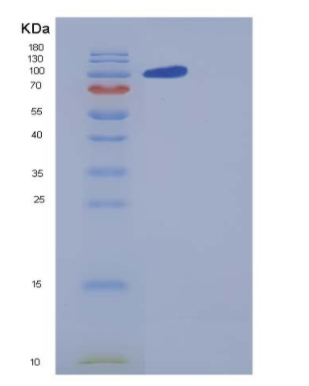 Recombinant Human Contactin 5 / CNTN5 Protein (His tag),Recombinant Human Contactin 5 / CNTN5 Protein (His tag)