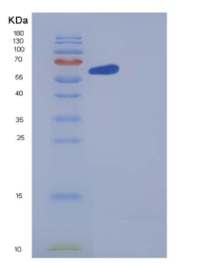 Recombinant Human GBP1 Protein (His tag),Recombinant Human GBP1 Protein (His tag)