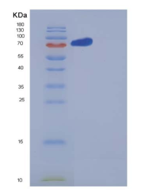 Recombinant Human Neuropilin-2 / NRP2 Protein (His tag),Recombinant Human Neuropilin-2 / NRP2 Protein (His tag)