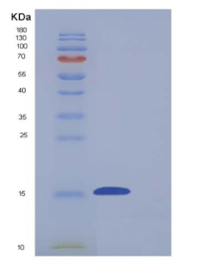 Recombinant Mouse CD7 Protein (His tag),Recombinant Mouse CD7 Protein (His tag)